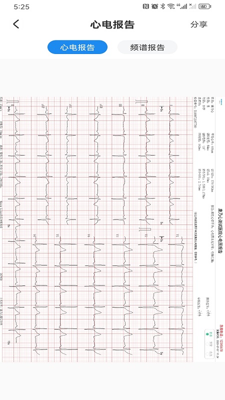 心电一张网_截图5