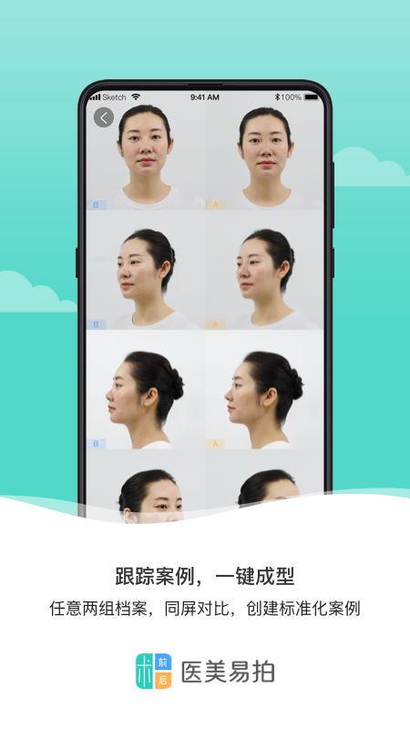 医美易拍_截图4