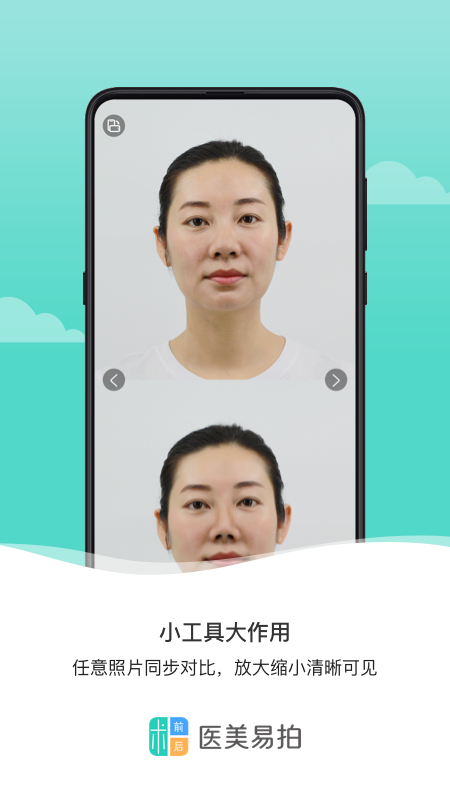 医美易拍_截图3