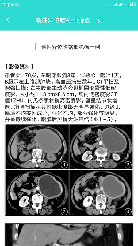 影像图鉴_截图4