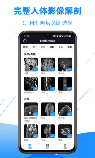 影像解剖图谱_截图2