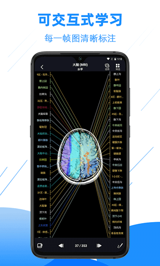 影像解剖图谱_截图4